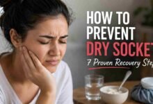 How to Prevent Dry Socket